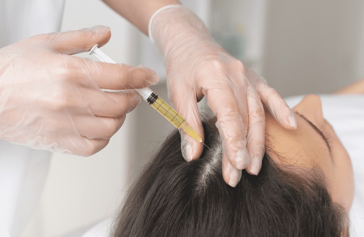 patient getting a hair filler injection