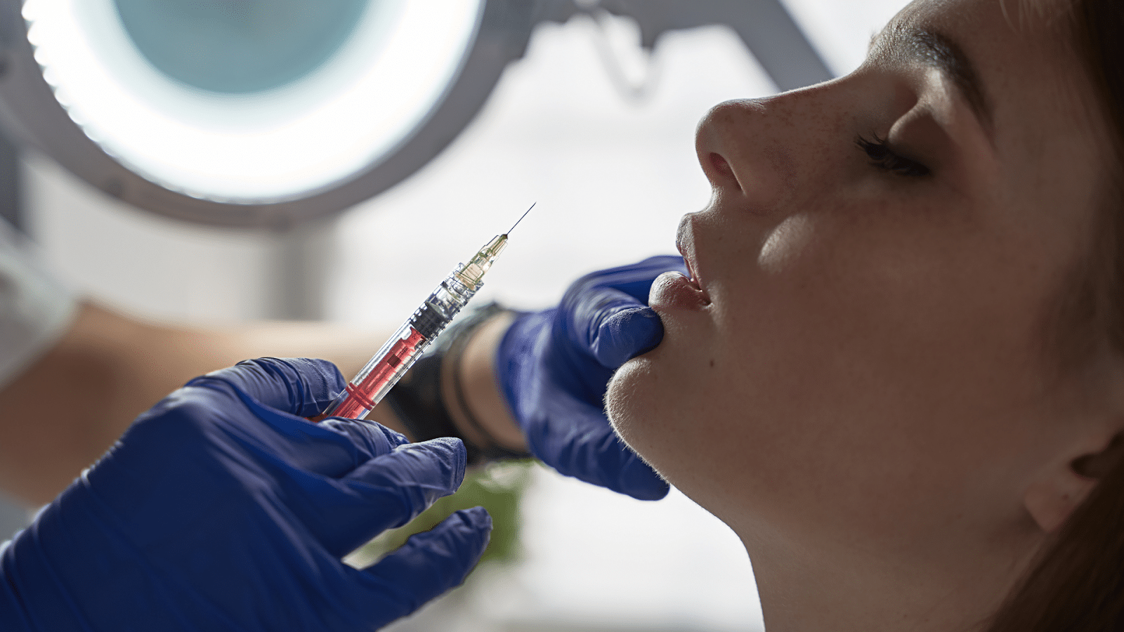 Woman getting ready to receive a Belotero lip filler.