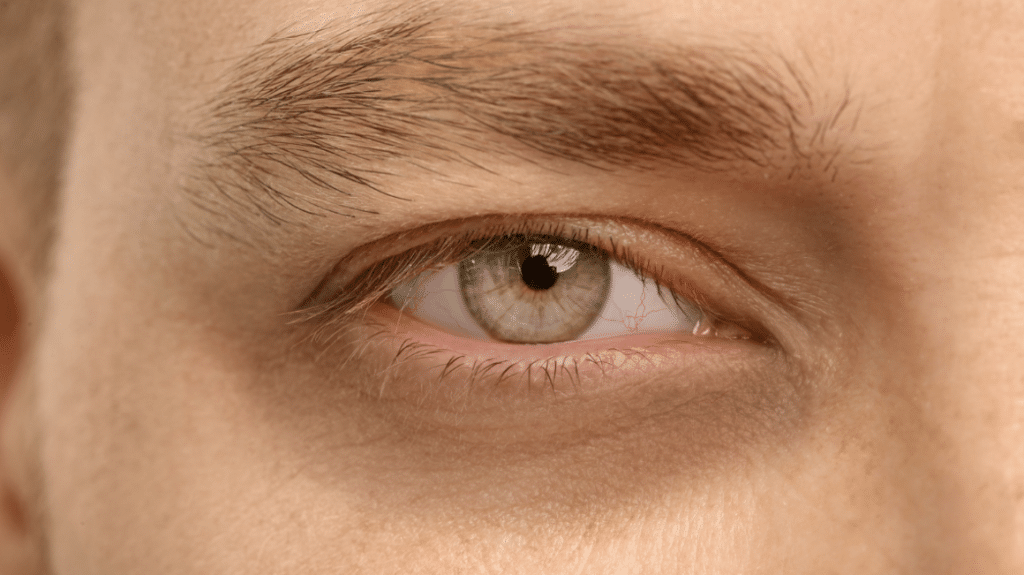 Understanding Under-Eye Concerns