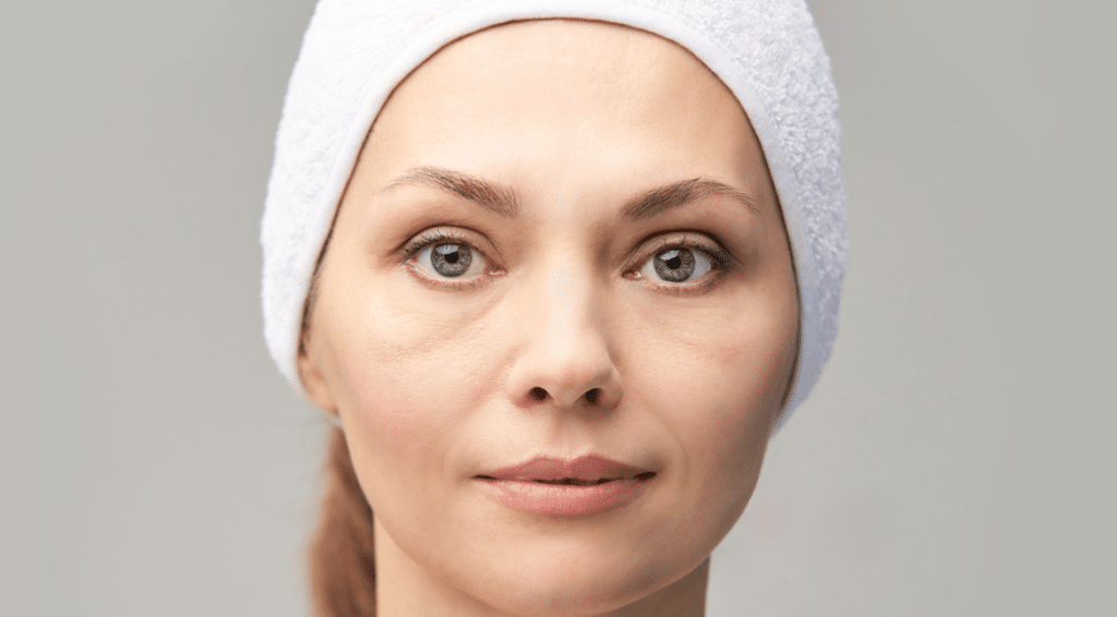 Benefits of Filorga Eye Filler